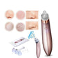 Electric Blackhead Remover