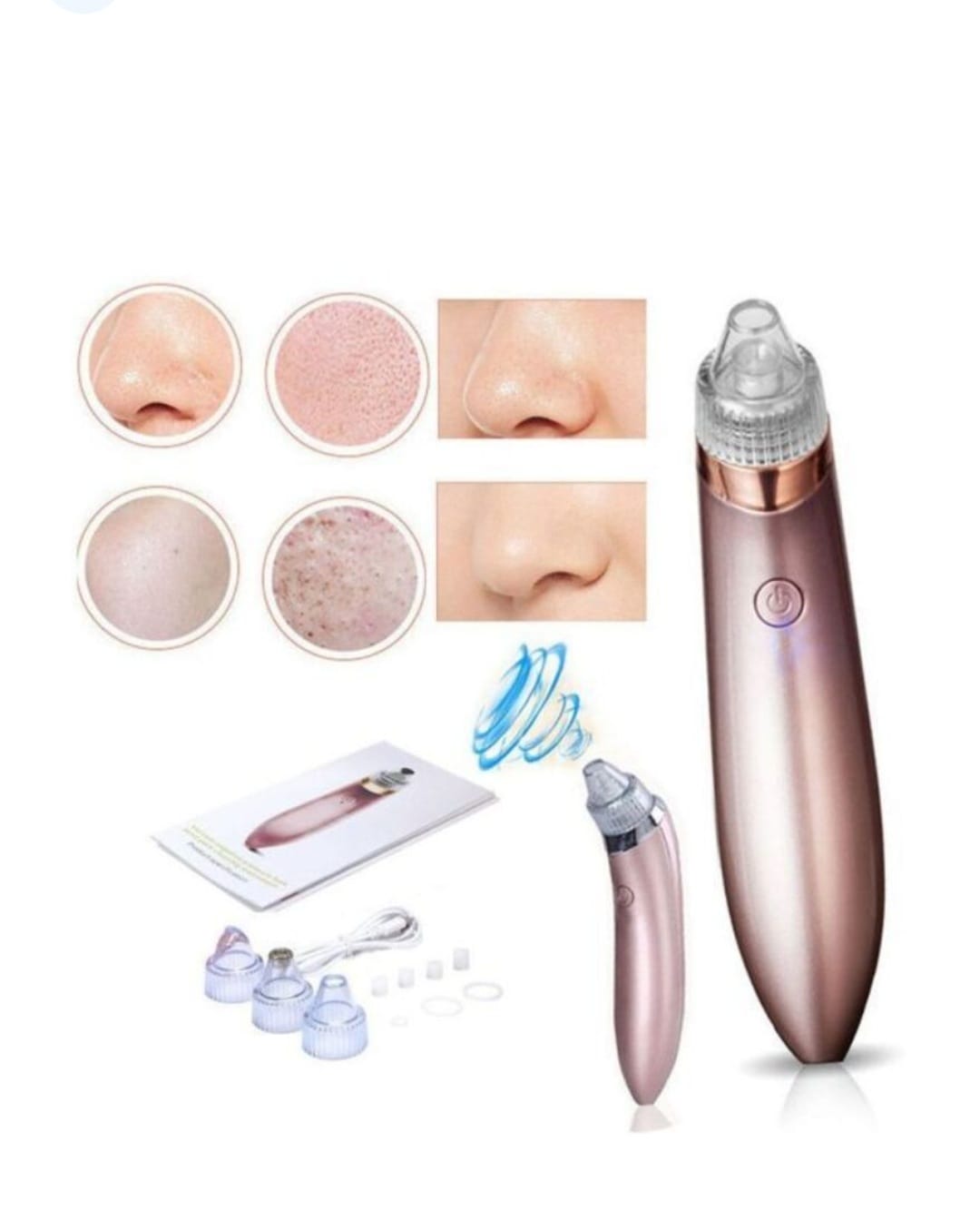 Electric Blackhead Remover